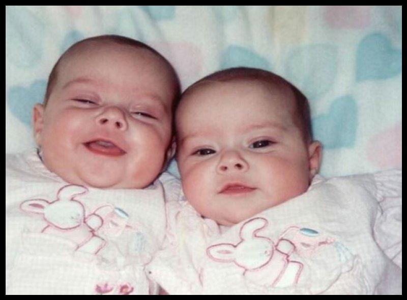 İkiz bebek